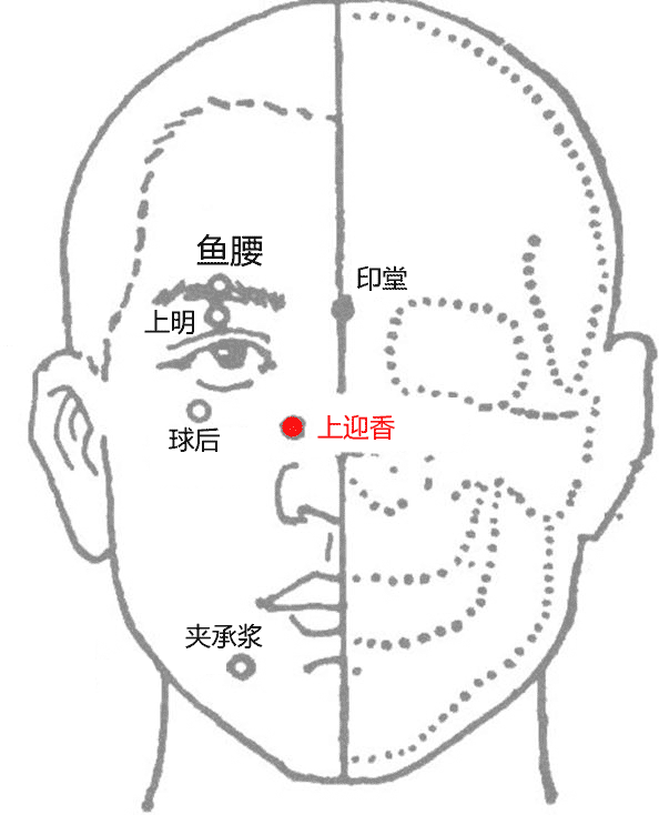 上迎香穴